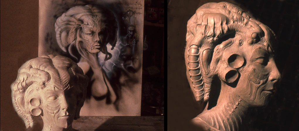 prosthesis effect Gastineau