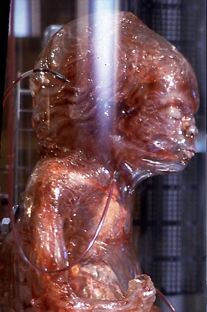 silicon foetus