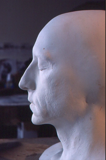 prosthesis effect