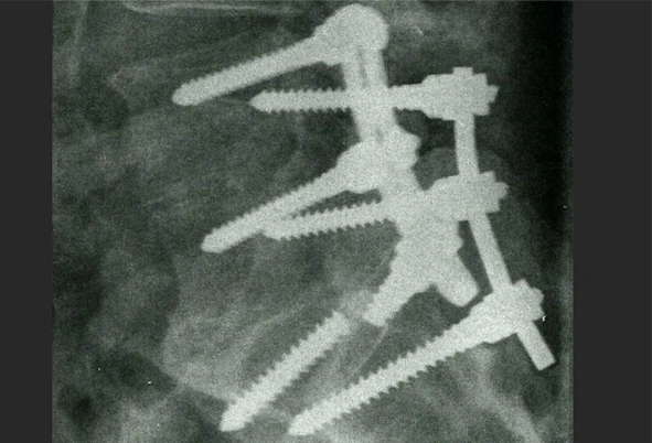 medical special effect