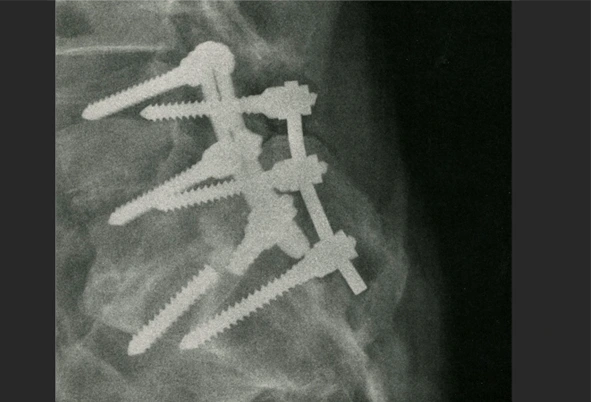 medical special effect