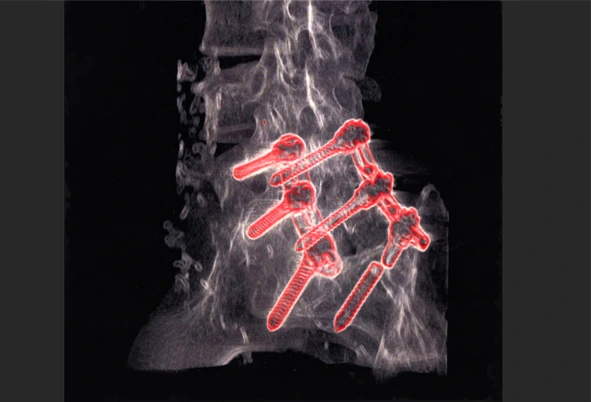 medical special effect