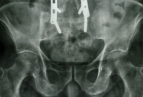 medical special effect